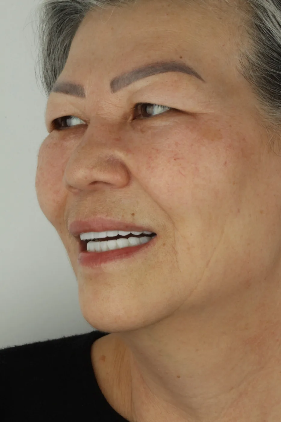A side-profile smiling portrait of a patient
