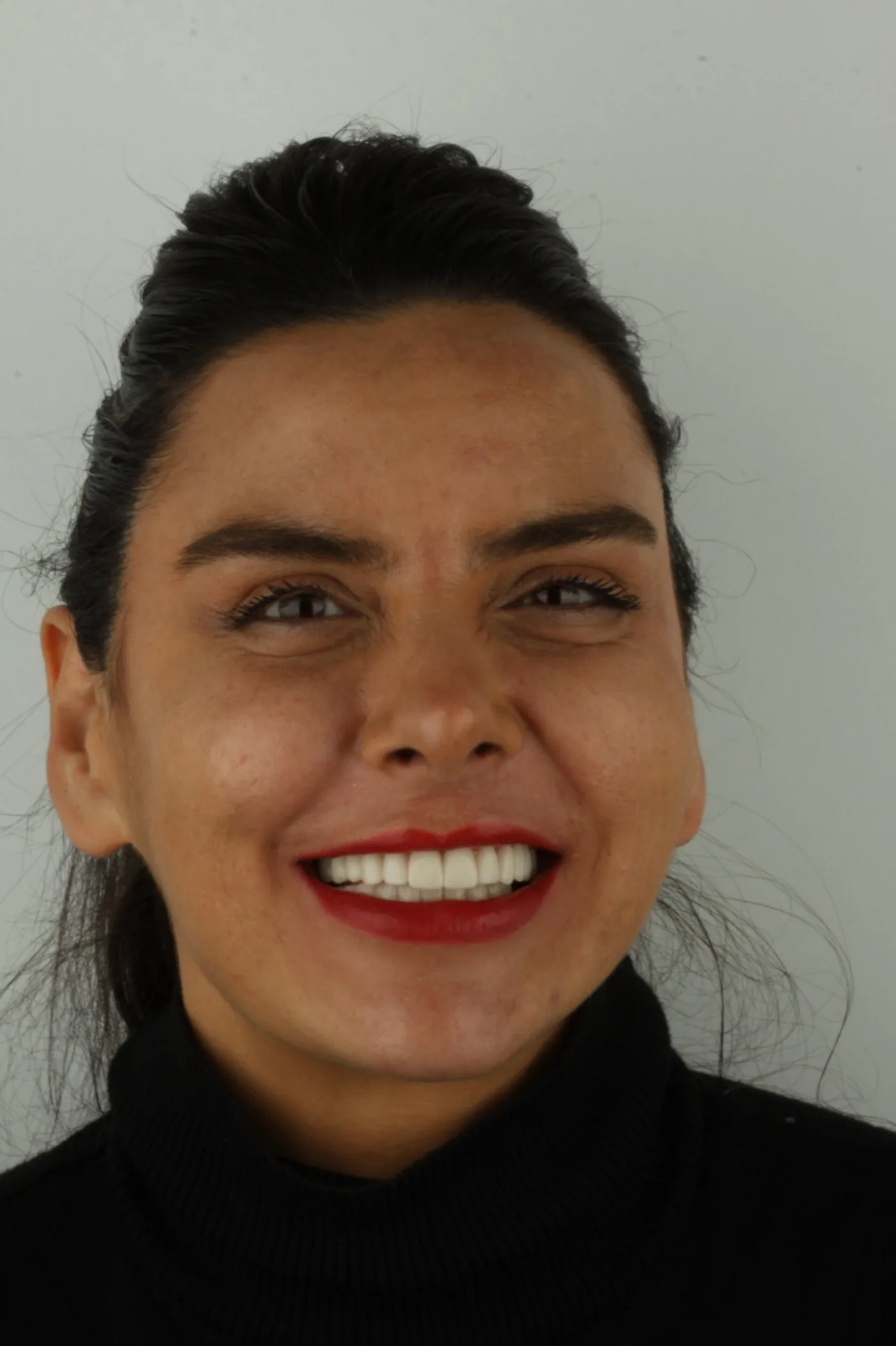 Case 3 — sonra, samimi gülümseme