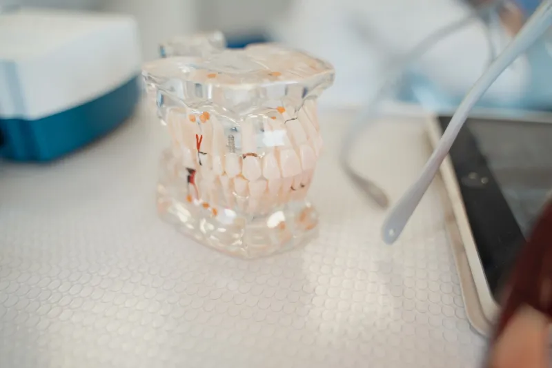 Diş implantı yapısını gösteren kesitli çene modeli